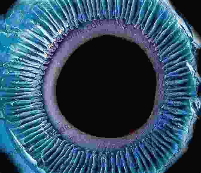 Microscopic Image Of An Eye Disease Pathology A Complete High Yield Study Guide For Optometry Students (1)