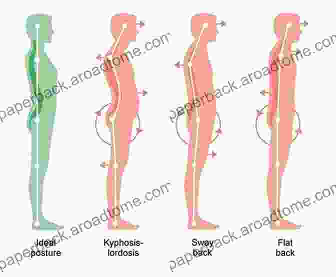 Role Of The Back In Movement And Posture Everything You Wanted To Know About The Back