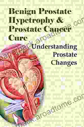 Benign Prostate Hypetrophy Prostate Cancer Cure: Understanding Prostate Changes