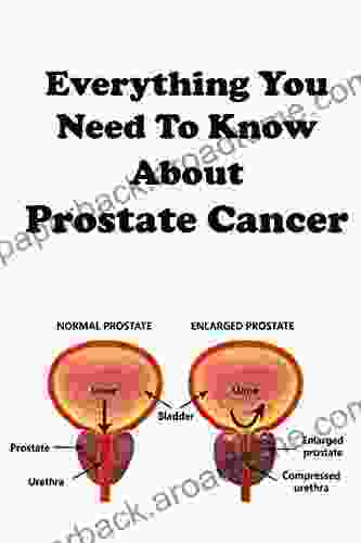 Everything You Want to Know About Prostate Cancer